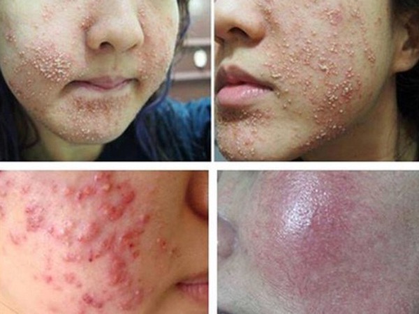 gel rửa mặt dịu nhẹ