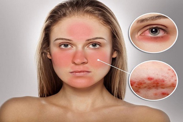 serum trắng da