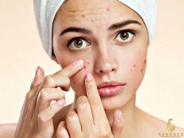 gel rửa mặt trị mụn