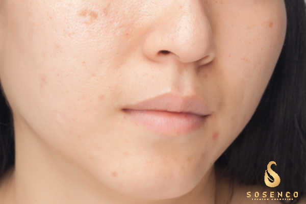  sữa rửa mặt dạng gel có tốt không