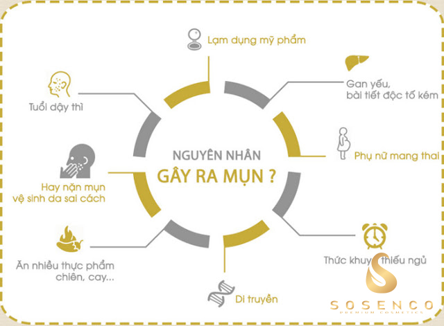 Serum Trị Mụn - Ngăn Ngừa Mụn Quay Trở Lại Hiệu Quả Nhất