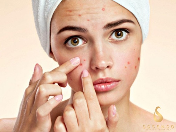 Bí kíp chăm sóc da và dùng sữa rửa mặt dạng gel cho da dầu
