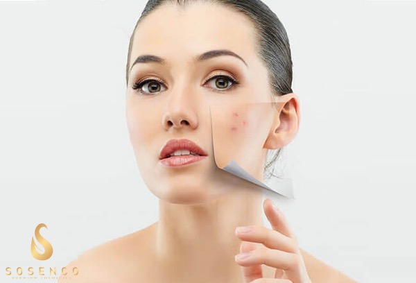 Cách lựa chọn serum trị mụn thâm cho da dầu hiệu quả nhất