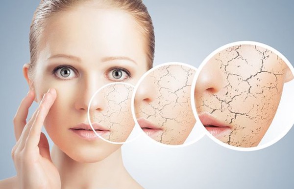Dấu hiệu dùng sữa rửa mặt không phù hợp, nên dùng gel rửa mặt dịu nhẹ