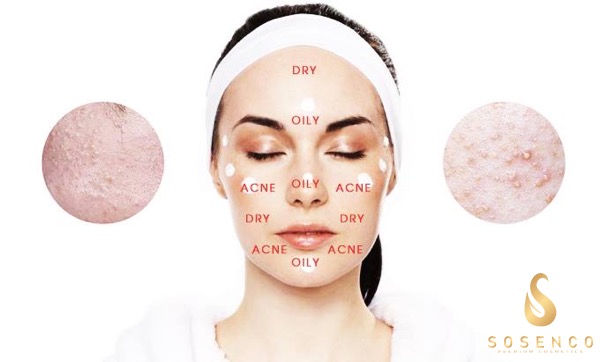Những câu hỏi nên giải đáp khi mua serum trị mụn và thâm tốt nhất