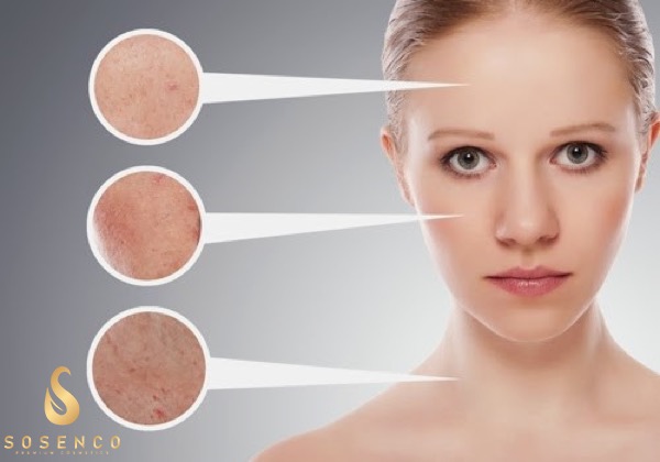 Những lưu ý quan trọng khi lựa chọn mua serum trị mụn thâm sẹo