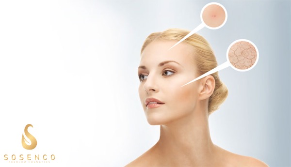 Serum trắng da mặt siêu tốc “lành hay dữ”