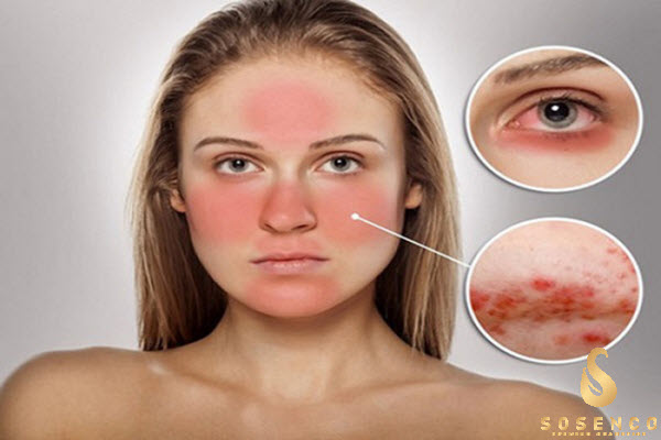 serum trị mụn thâm giá rẻ