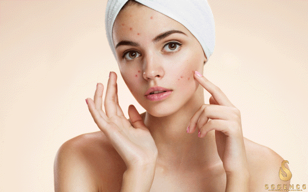 sữa rửa mặt gel trị mụn