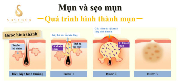 sữa rửa mặt gel
