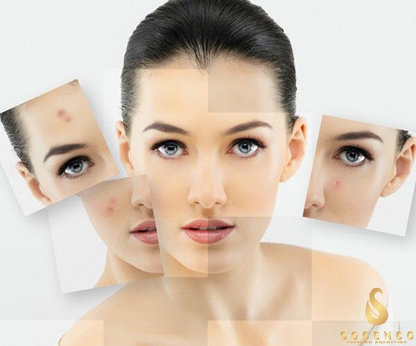 sữa rửa mặt gel