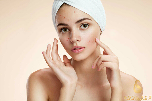 sữa rửa mặt gel